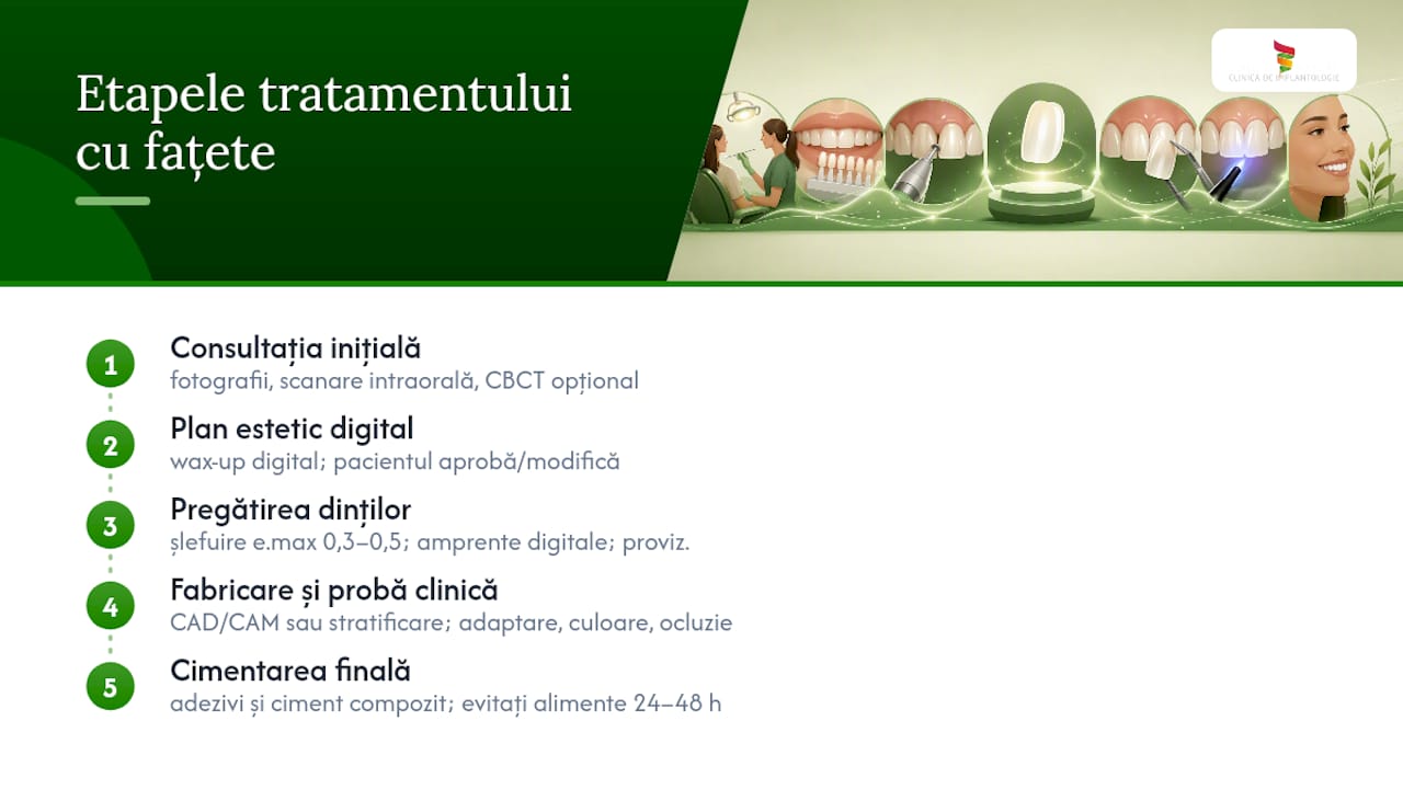 Cum decurge tratamentul cu fațete ceramice: etape și calendar — overview diagram