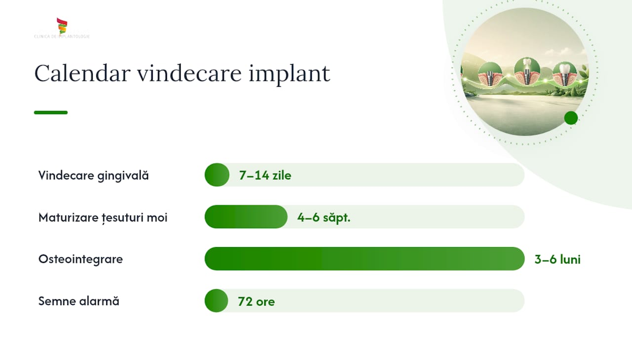 Vindecare după implant: cât durează și ce să faci 1 Etapele vindecării după inserarea unui implant dentar – cum decurge procesul și la ce să te aștepți