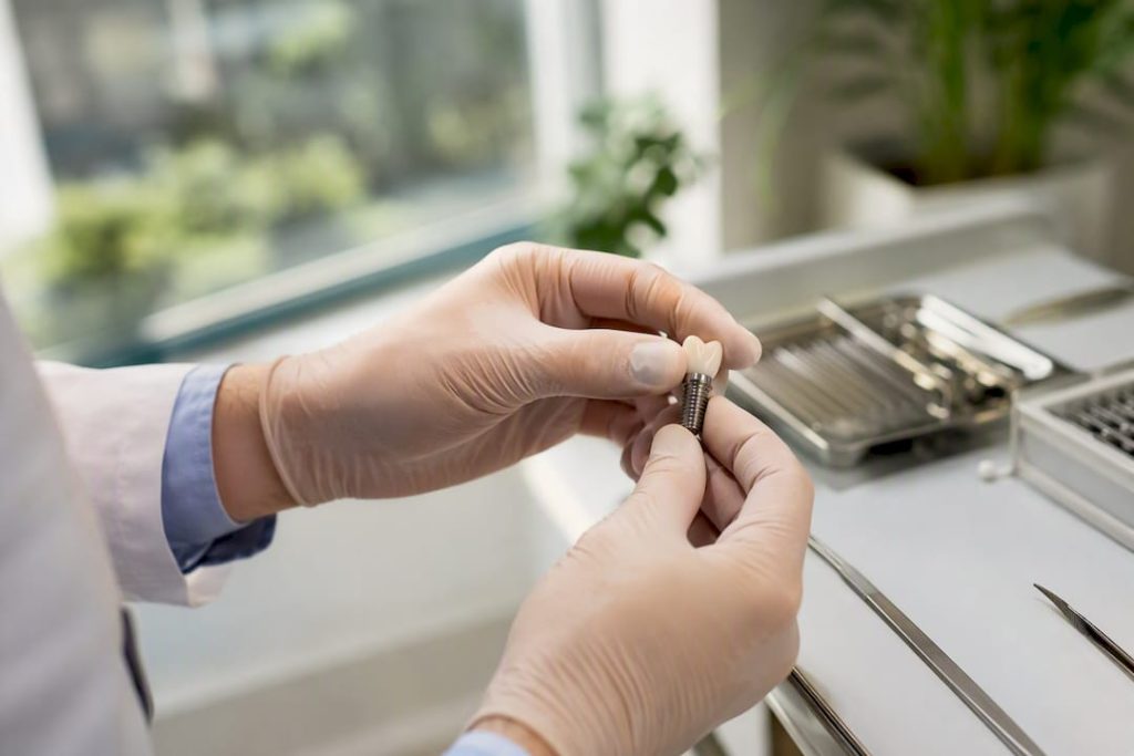 Medicul stomatolog montează un implant dentar de cea mai bună calitate.