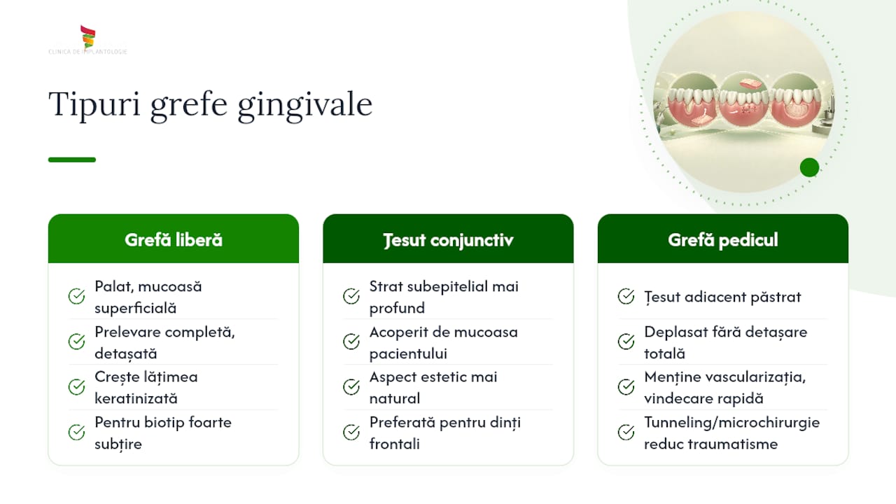 Diagramă comparativă a tipurilor de grefon gingival