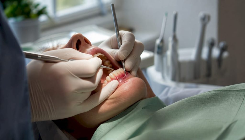 Mâinile dentistului efectuând un grefon gingival