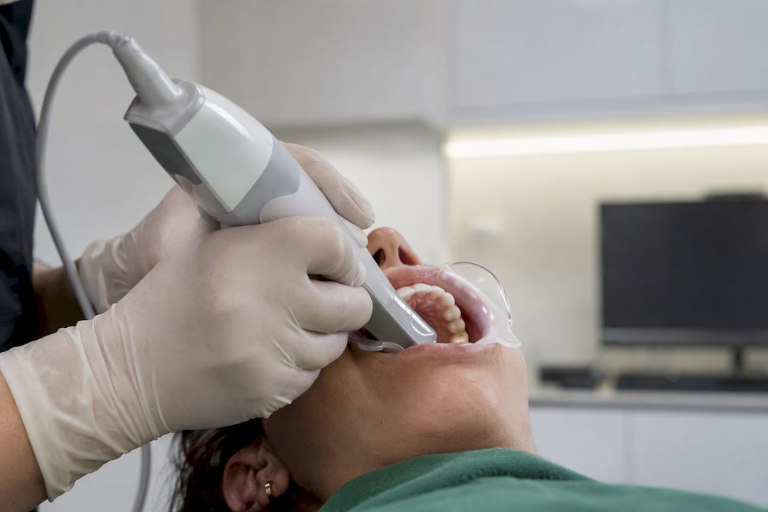 Scanner intraoral care capturează o amprentă dentară digitală