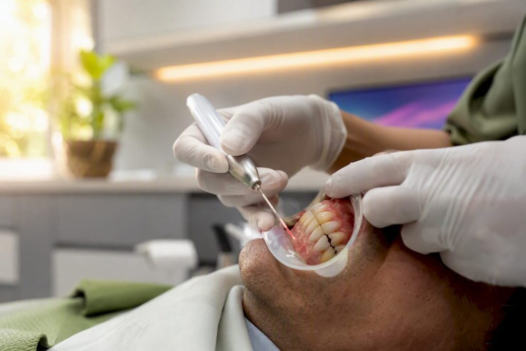 Fibră laser folosită în terapia parodontală