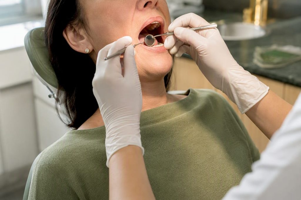 Evaluare orală pentru candidatura All-on-4