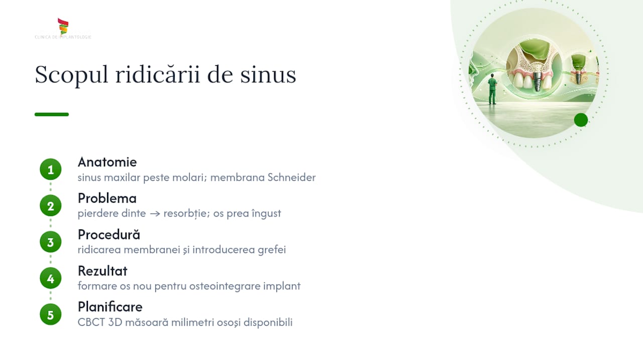 Ridicare sinus pentru implant dentar: cui i se recomandă 1 Ce este ridicarea de sinus și ce urmărește în implantologie — overview diagram