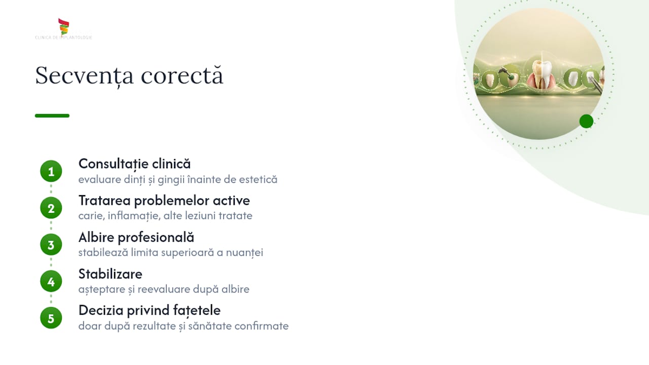 Ce spunem noi despre secvența albire-fațete — overview diagram